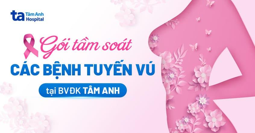 Khám tầm soát bệnh tuyến vú: Chỉ định, quy trình và lưu ý