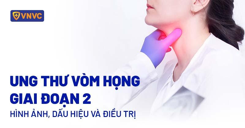 Ung thư vòm họng giai đoạn cuối (giai đoạn 4): Triệu chứng và điều trị