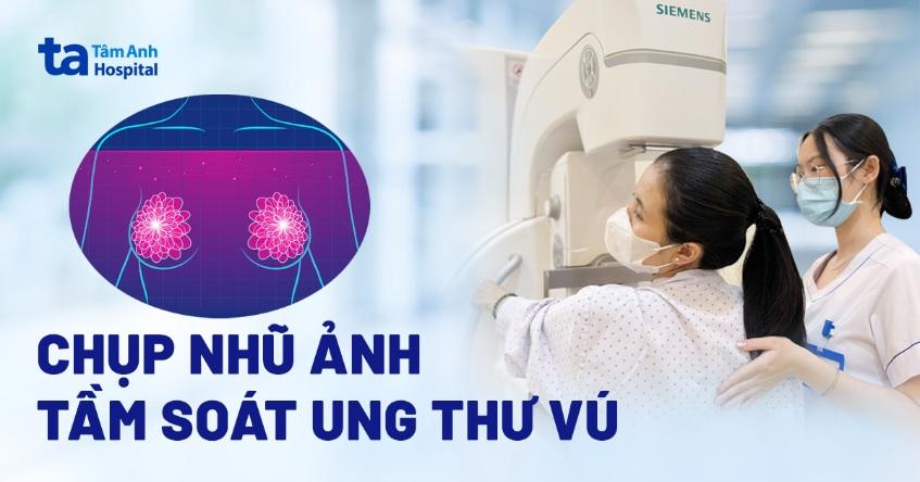 Chụp nhũ ảnh tầm soát ung thư vú là gì? Những lưu ý cần biết