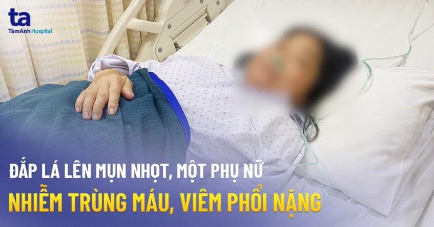 Chữa mụn nhọt bằng lá cây #9 vị cây quý như "Thần dược"