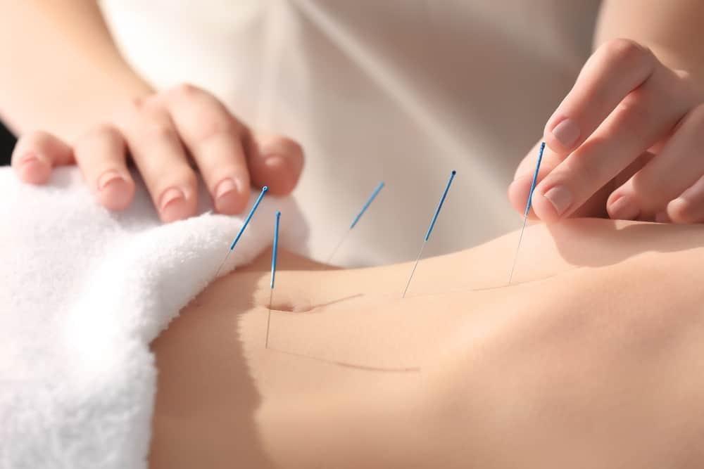 mẹo dân gian chữa bệnh hen suyễn bằng châm cứu